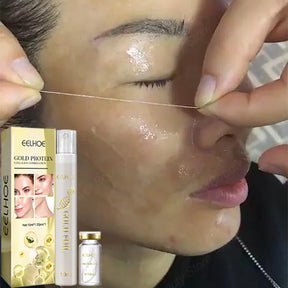 Fio Rejuvenecedor MaxGold - MyBeauty